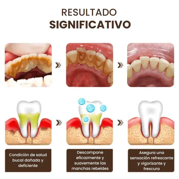 Instant White - Pasta de dientes blanqueadora intensiva con Ácido hialurónico